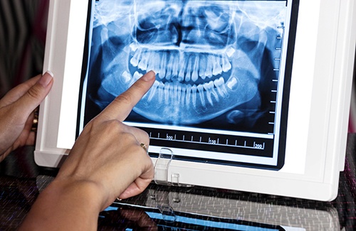 Dentist reviewing X-ray on tablet